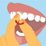 Подвижность зуба