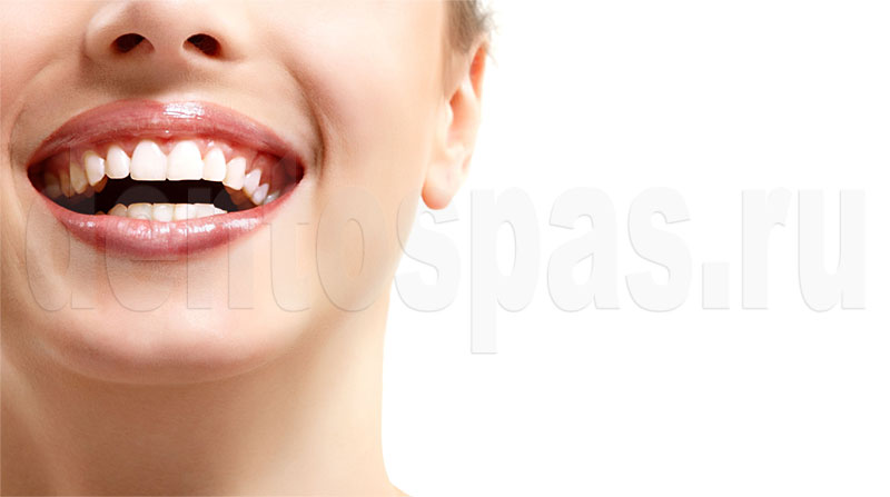 Улыбка - восстановление зубов