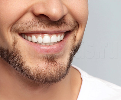 Белоснежные зубы после отбеливания у мужчины