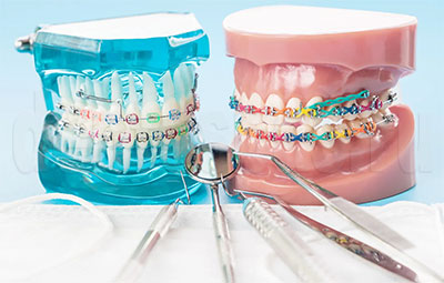 Брекет-системы и стоматологический инструмент