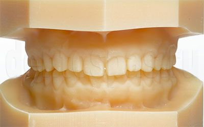 Модель зубо-челюстной системы