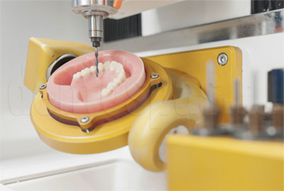 Изготовление зубных протезов при помощи технологии CAD/CAM