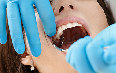 Хирургическое лечение зубов